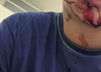 Adolescente de 15 anos é agredido dentro de sala de aula por colega e imagens repercutem