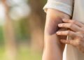 Leucemia: fique atento a esses 6 sinais!