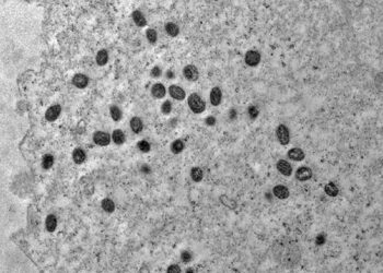 OMS convoca reunião de emergência para tratar de epidemia de monkeypox