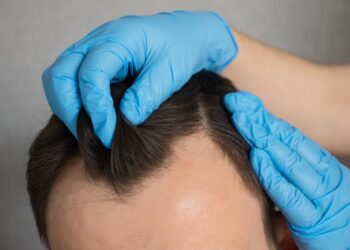 BELEZA: Truques para disfarçar falhas no cabelo masculino