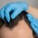 BELEZA: Truques para disfarçar falhas no cabelo masculino