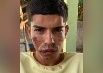 Assassino de médico tenta fugir, é baleado e morre em hospital, após ser socorrido