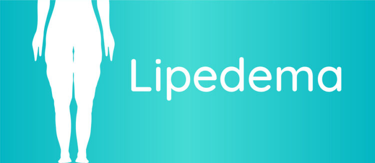 Como estão os famosos que sofrem de lipedema hoje?
