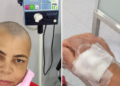 Após 3 cirurgias, quimio e radioterapia, Vilma precisa de doações para seguir tratando o câncer