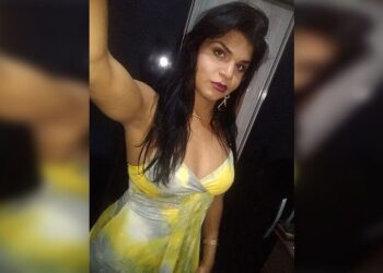 Morre na Santa Casa a travesti que teve 90 % do corpo incendiado por duas colegas, na Capital