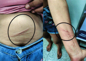 Homem é preso por agredir ex-mulher, pisotear sua cabeça e jogar fezes de cães em seu rosto
