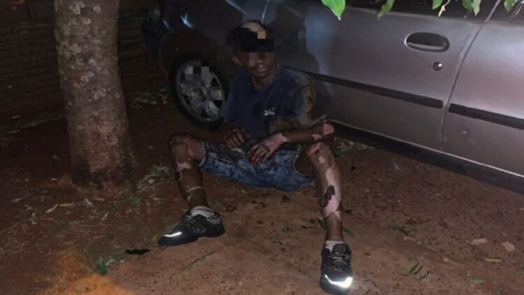 Homem tem queimaduras graves no corpo enquanto furtava fios, em Dourados