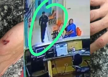 Enfermeira é atacada dentro do UPA Universitário por homem que quase a estupra