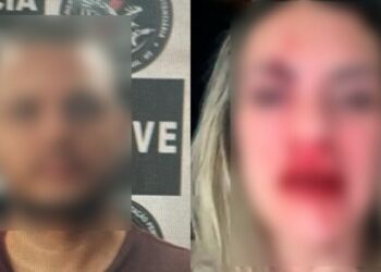 Jornalista teme pela vida, após soltura de namorado agressor há 9 dias do crime