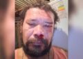 Homem é atacado por onça ao defender cão de estimação no Mirante da Capivara
