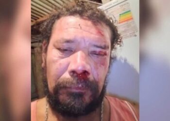 Homem é atacado por onça ao defender cão de estimação no Mirante da Capivara
