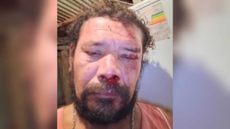 Homem é atacado por onça ao defender cão de estimação no Mirante da Capivara