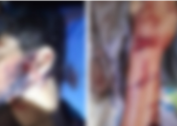 Peão fica em estado grave ao ser atacado por onça em fazenda do Pantanal em Corumbá