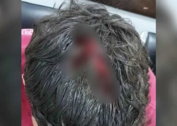 Dois jovens ficam feridos durante tentativa de homicídio na Praça do Povo em Sonora