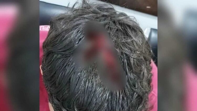 Dois jovens ficam feridos durante tentativa de homicídio na Praça do Povo em Sonora