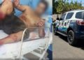 Homem agride deficiente físico, toma arma de PM, resiste à prisão é baleado e preso em Três Lagoas