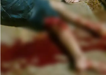 Colisão entre duas motos no Bairro Campo Alto deixa motociclista com fratura exposta