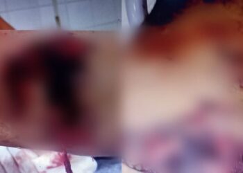 Pitbull ataca homem em chácara do Indubrasil e fere gravemente pernas e um dos braços