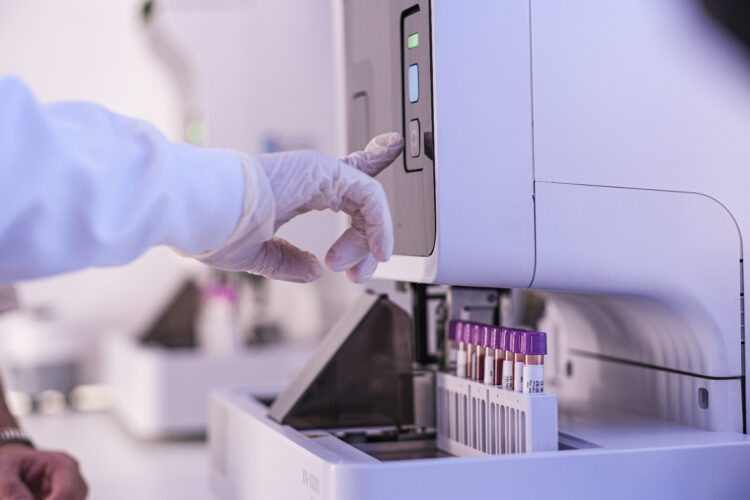 Cassems inaugura Núcleo de Processamento de Amostras e reduz para 24h prazo de resultados de exames complexos