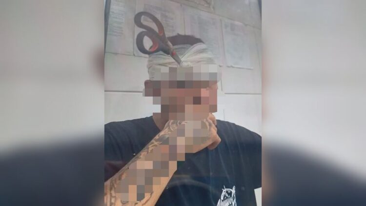 Em brincadeira de “croc”, rapaz acaba com tesoura cravada na cabeça pela namorada em Água Clara