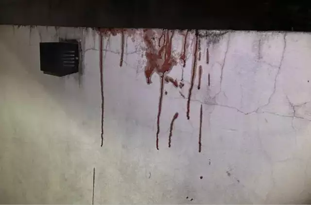 Frentista de 20 anos é alvo de atentado e baleado três vezes ao pular muros em Três Lagoas